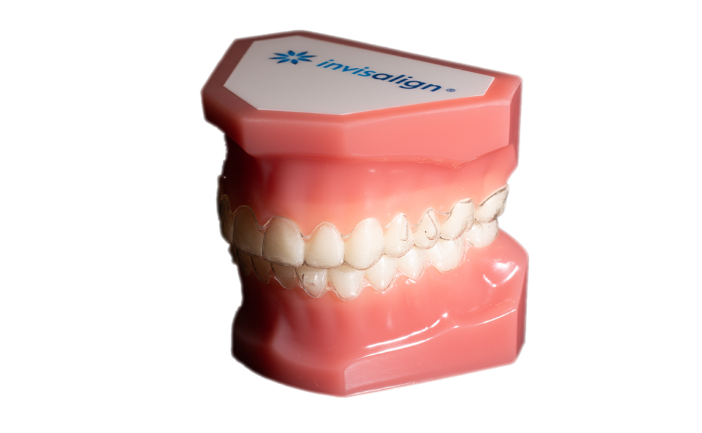 マウスピース型矯正装置に対する学会の見解 イロドリ矯正歯科