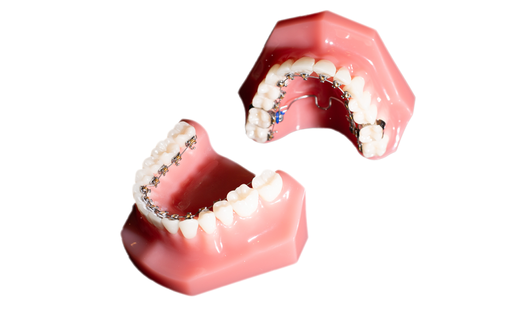 矯正歯科治療の需要 イロドリ矯正歯科